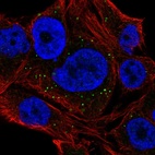 Anti-NEURL2 Antibody