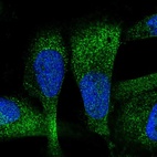Anti-ZC3H7A Antibody