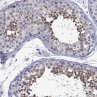 Immunohistochemical staining of human testis shows high expression.