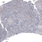 Immunohistochemical staining of human tonsil shows no positivity in non-germinal center cells as expected.