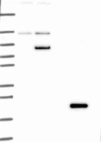 Lane 1: Marker [kDa] 250, 130, 95, 72, 55, 36, 28, 17, 10 | Lane 2: RT4 | Lane 3: U-251 MG | Lane 4: Human Plasma | Lane 5: Liver | Lane 6: Tonsil
