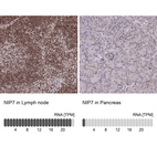 Anti-NIP7 Antibody