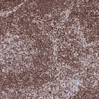 Immunohistochemical staining of human lymph node shows high expression.
