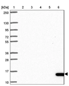 Lane 1: Marker [kDa] 250, 130, 95, 72, 55, 36, 28, 17, 10_br/_Lane 2: Human cell line RT-4_br/_Lane 3: Human cell line U-251MG sp_br/_Lane 4: Human plasma (IgG/HSA depleted)_br/_Lane 5: Human liver tissue_br/_Lane 6: Human tonsil tissue