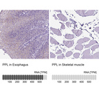 Anti-PPL Antibody