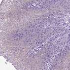 Immunohistochemical staining of human esophagus shows high expression.