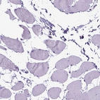 Immunohistochemical staining of human skeletal muscle shows low expression as expected.