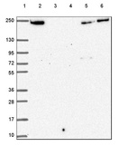 Lane 1: Marker [kDa] 250, 130, 95, 72, 55, 36, 28, 17, 10_br/_Lane 2: Human cell line RT-4_br/_Lane 3: Human cell line U-251 MG_br/_Lane 4: Human plasma_br/_Lane 5: Human Liver tissue_br/_Lane 6: Human Tonsil tissue