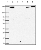 Lane 1: Marker [kDa] 250, 130, 95, 72, 55, 36, 28, 17, 10_br/_Lane 2: Human cell line RT-4_br/_Lane 3: Human cell line U-251 MG_br/_Lane 4: Human plasma_br/_Lane 5: Human Liver tissue_br/_Lane 6: Human Tonsil tissue