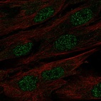 Anti-MAB21L1 Antibody