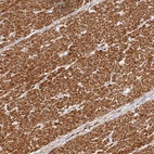 Anti-METTL22 Antibody