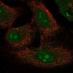 Anti-PRY2 Antibody