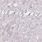 Immunohistochemical staining of human heart muscle shows low expression as expected.