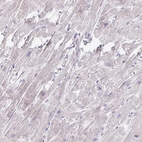 Immunohistochemical staining of human heart muscle shows low expression as expected.
