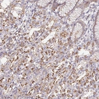 Anti-DISP2 Antibody