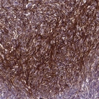 Anti-EMILIN3 Antibody