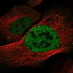 Immunofluorescent staining of human cell line U-2 OS shows localization to nucleoplasm & vesicles.