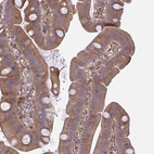 Immunohistochemical staining of human small intestine shows moderate to strong cytoplasmic positivity in glandular cells.