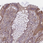 Immunohistochemical staining of human rectum shows moderate to strong cytoplasmic positivity in glandular cells.