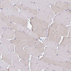 Immunohistochemical staining of human skeletal muscle shows no positivity in myocytes.