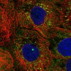 Immunofluorescent staining of human cell line A-431 shows localization to cytosol & mitochondria.