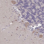 Immunohistochemical staining of human cerebellum shows moderate cytoplasmic positivity in Purkinje cells.