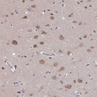Immunohistochemical staining of human cerebral cortex shows moderate cytoplasmic positivity in neuronal cells.