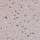 Immunohistochemical staining of human cerebral cortex shows moderate cytoplasmic positivity in neuronal cells.