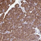 Immunohistochemical staining of human pancreas shows moderate cytoplasmic positivity in exocrine glandular cells.