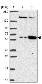 Lane 1: Marker [kDa] 250, 130, 95, 72, 55, 36, 28, 17, 10_br/_Lane 2: Human cell line RT-4_br/_Lane 3: Human cell line U-251MG sp
