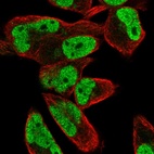 Immunofluorescent staining of human cell line RH-30 shows localization to nucleoplasm.