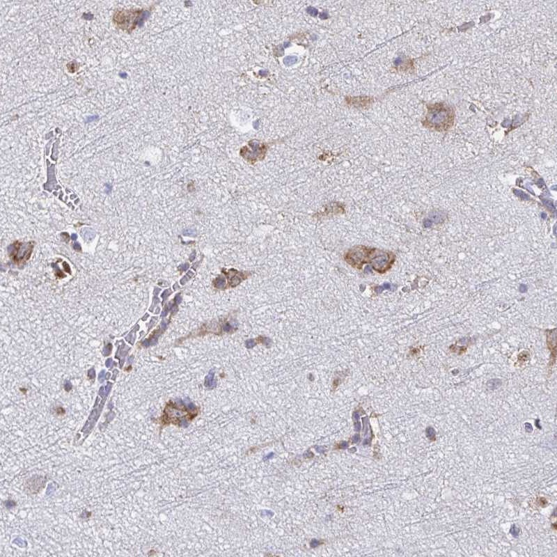 Anti-TMEM241 Antibody