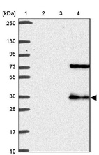 Lane 1: Marker [kDa] 250, 130, 95, 72, 55, 36, 28, 17, 10_br/_Lane 2: Human cell line RT-4_br/_Lane 3: Human cell line U-251MG sp_br/_Lane 4: Human plasma (IgG/HSA depleted)