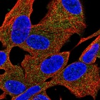 Immunofluorescent staining of human cell line SH-SY5Y shows localization to cytosol.