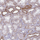 Immunohistochemical staining of human kidney shows moderate cytoplasmic/membranous positivity in cells in tubules.
