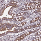 Immunohistochemical staining of human small intestine shows strong positivity in cytoplasm granular/membranous in glandular cells.