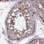 Anti-MINOS1 Antibody