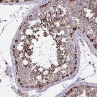 Immunohistochemical staining of human testis shows strong positivity in cytoplasm granular/membranous in cells in seminiferous ducts.