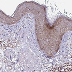 Immunohistochemical staining of human skin shows moderate cytoplasmic/membranous positivity in squamous epithelial cells.