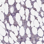 Immunohistochemical staining of human bone marrow shows weak cytoplasmic positivity in hematopoietic cells.