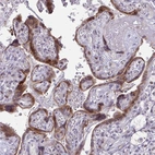 Anti-DLX4 Antibody