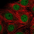 Anti-SMARCD2 Antibody