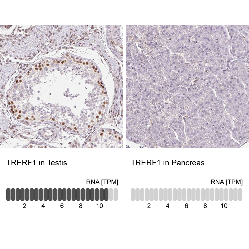 Anti-TRERF1 Antibody