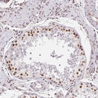 Immunohistochemical staining of human testis shows high expression.