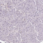 Immunohistochemical staining of human pancreas shows low expression as expected.