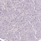 Immunohistochemical staining of human pancreas shows low expression as expected.