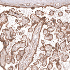 Immunohistochemical staining of human placenta shows moderate cytoplasmic and membranous positivity in trophoblastic cells.