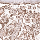 Immunohistochemical staining of human placenta shows moderate cytoplasmic and membranous positivity in trophoblastic cells.