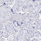 Anti-PRDM7 Antibody