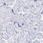 Immunohistochemical staining of human placenta shows no positivity in trophoblastic cells as expected.
